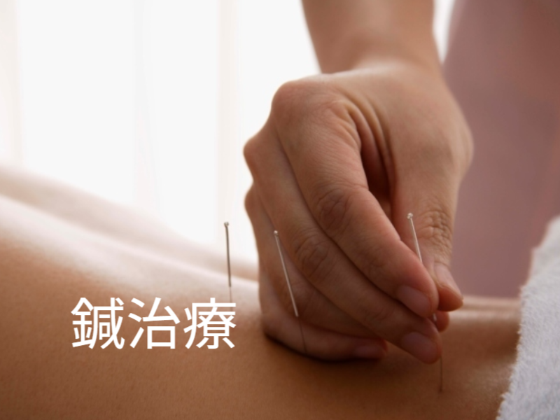 腰に鍼を打つ